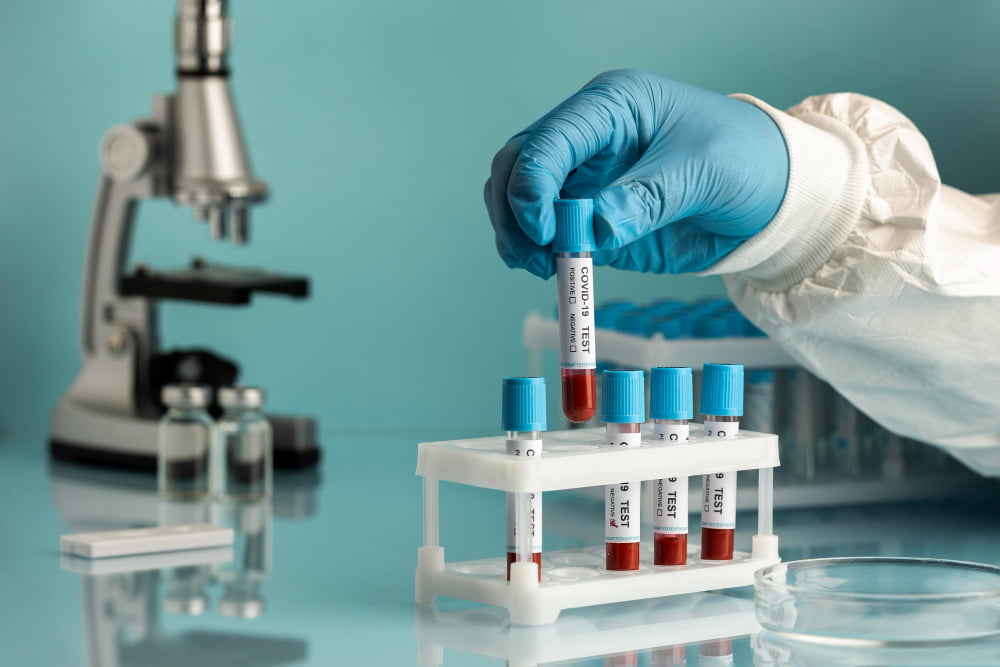 Blood Tests For General Health Check-ups di Rawang